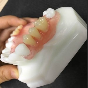 Valplast