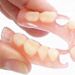 Flexible Denture