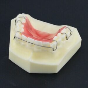 Hawley Retainer
