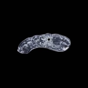 Prosthetic Stent
