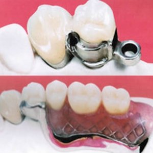 Dental Ear