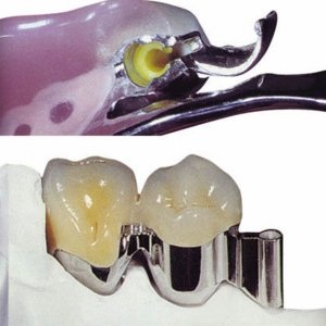 Stud Attachment