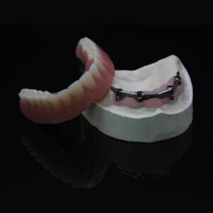 Implant Bar
