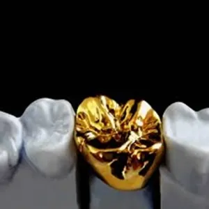High Noble Metal